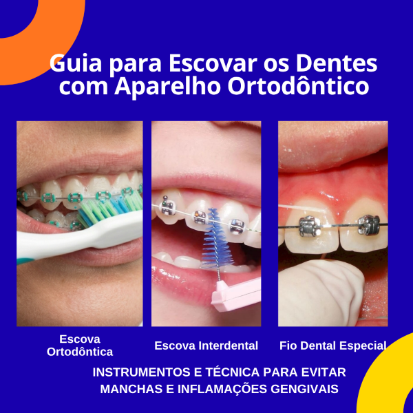 Guia Prático para Escovar os Dentes com Aparelho Ortodôntico