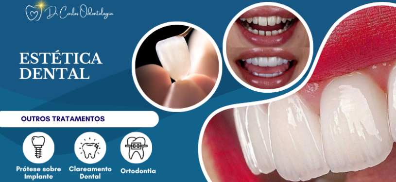 ESTÉTICA DENTAL (1)