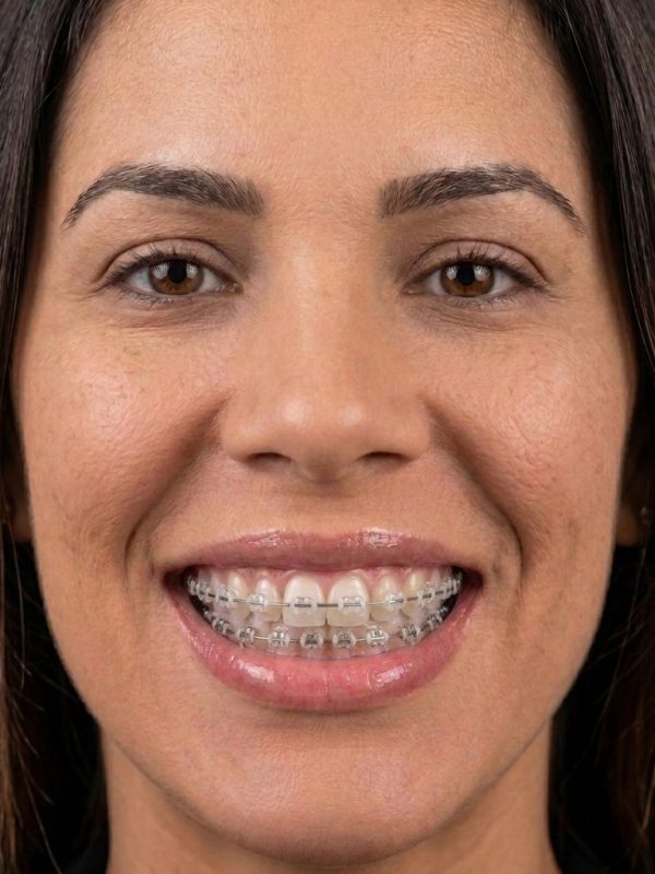 Older_woman_wearing_orthodontic_…_202609051123
