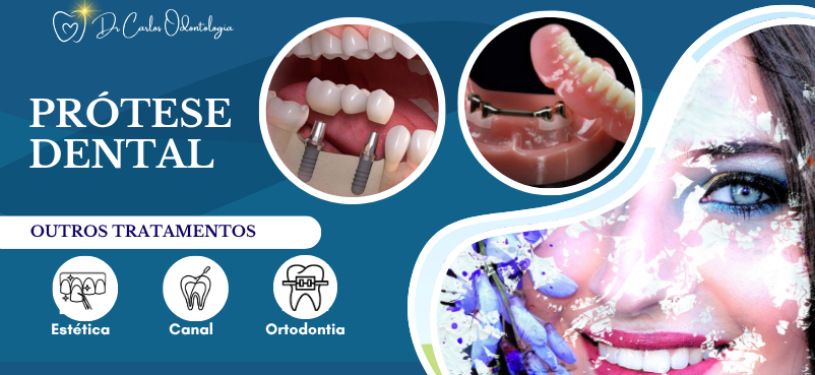 Prótese Dental (2)