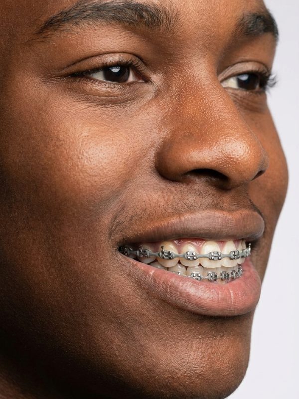 Young_man_wearing_orthodontic_br…_202609051049